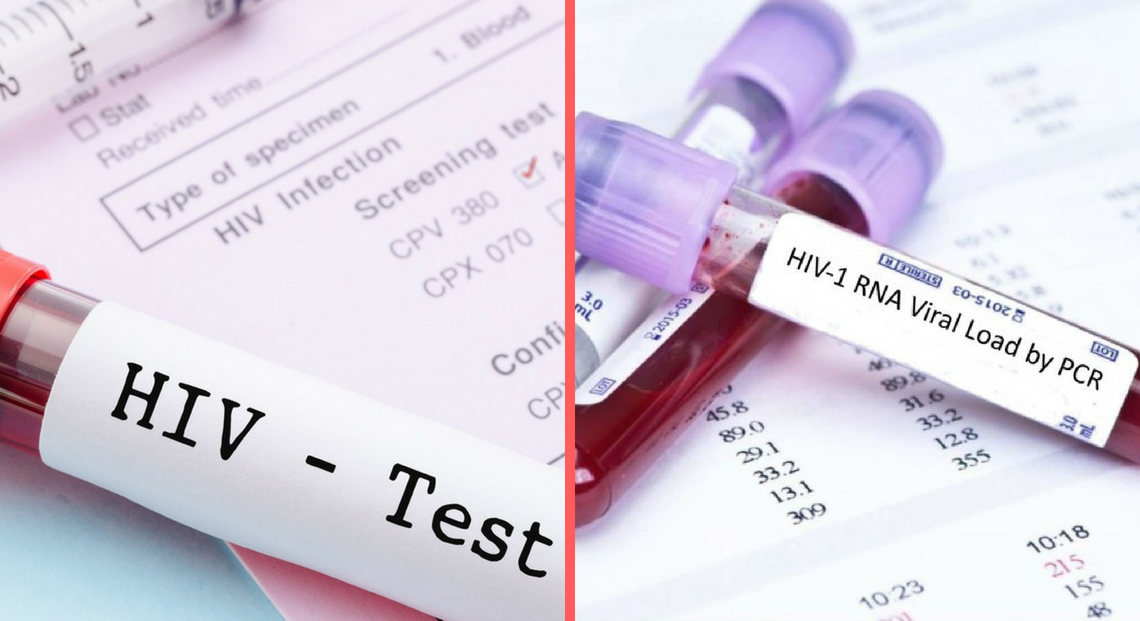 inconsistencies in self-reported HIV testing and treatment S. Africa